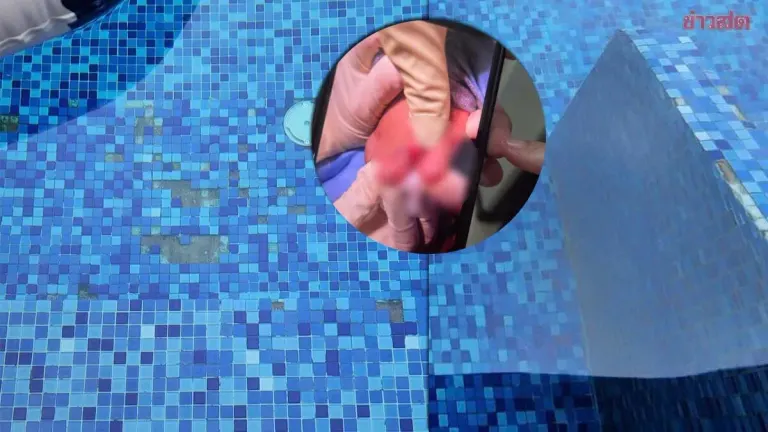 Pool Villa Guest Warns Of Safety Hazards After Child Injured