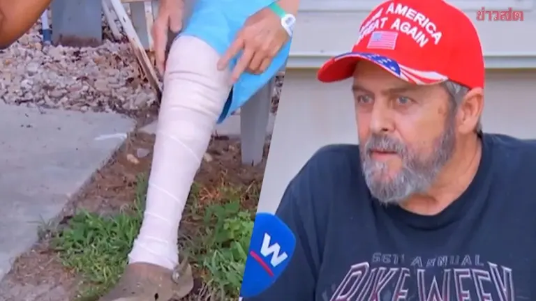 Florida Man Survives Crocodile Attack Using Bare Hands