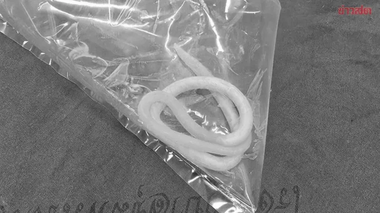 Roundworms Extracted From Toddler's Mouth After Vomiting