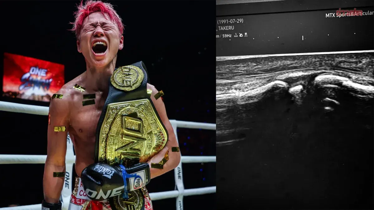 Takeru Discovers Broken Leg After Defeating Tank – Admits He Was Lucky to Win
