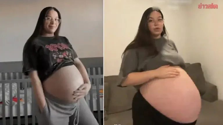Viral: Pregnant Mother Expecting Twins Flaunts Massive Belly, Starkly Different from First Twin Pregnancy, Video Hits 22 Million Views