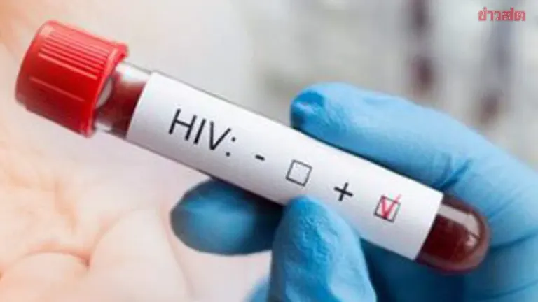 Thailand Reports 8,000-9,000 New HIV Cases Yearly, Nearly 60,000 Unaware