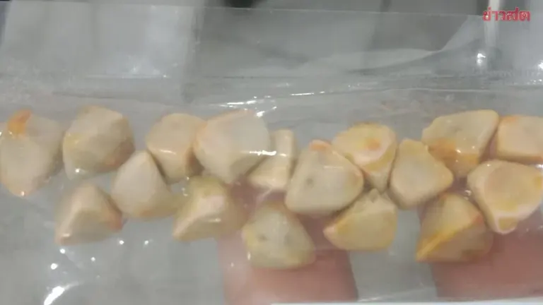 Woman's Warning: Daily Iced Tea Habit Led to Nearly 50 Kidney Stones