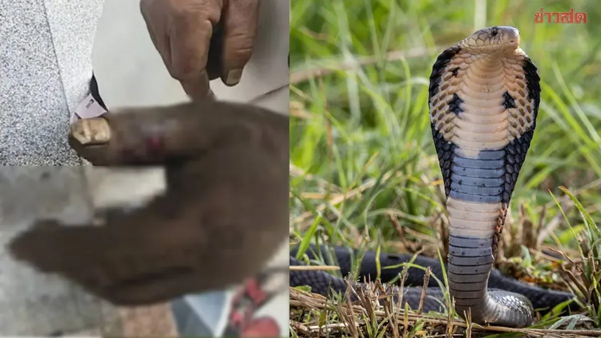 Chinese Woman Poisoned Trying to Suck Snake Venom from Husband