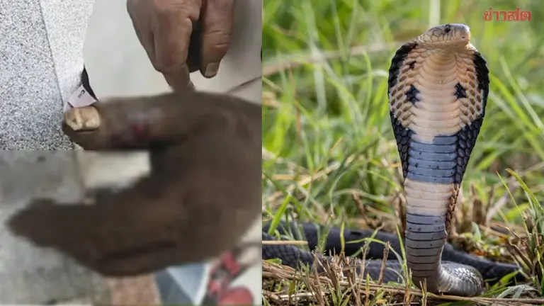 Chinese Woman Poisoned Trying to Suck Snake Venom from Husband