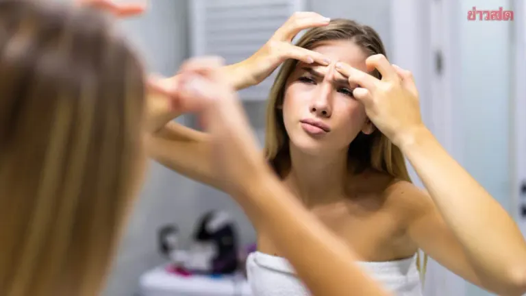 Woman's Acne Scratch Becomes Viral Wart in Six Months