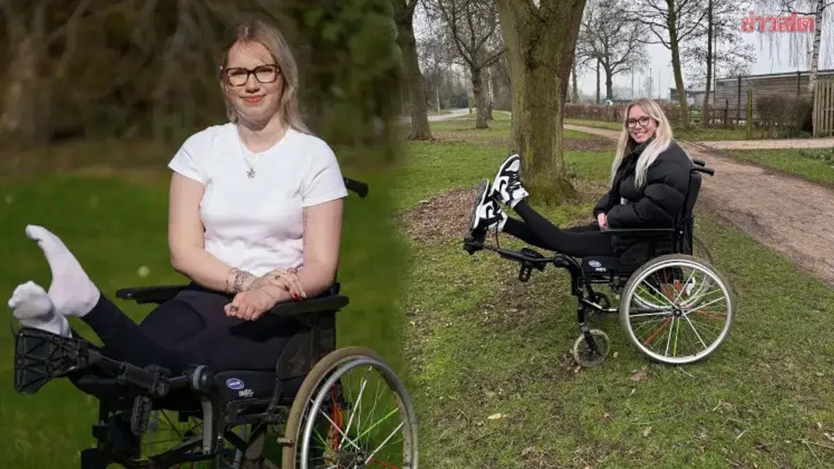 21-Year-Old Woman with Severely Deformed Legs Prepares for Double Amputation After 8 Years of Chronic Pain