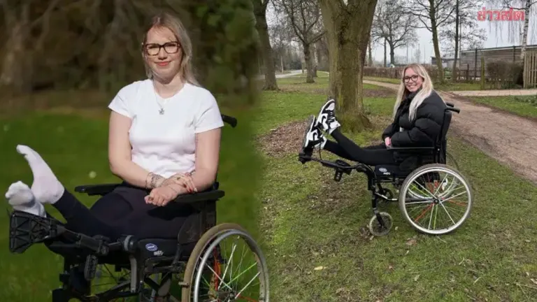 21-Year-Old Woman with Severely Deformed Legs Prepares for Double Amputation After 8 Years of Chronic Pain