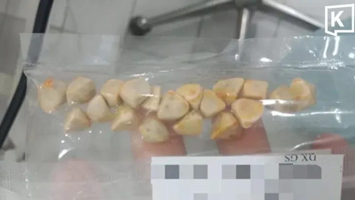 Woman's Gallstone Surgery Blamed on Daily Thai Iced Tea