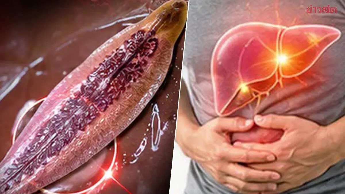 Doctor Warns Raw Fish Parasites Can Cause Liver Cancer
