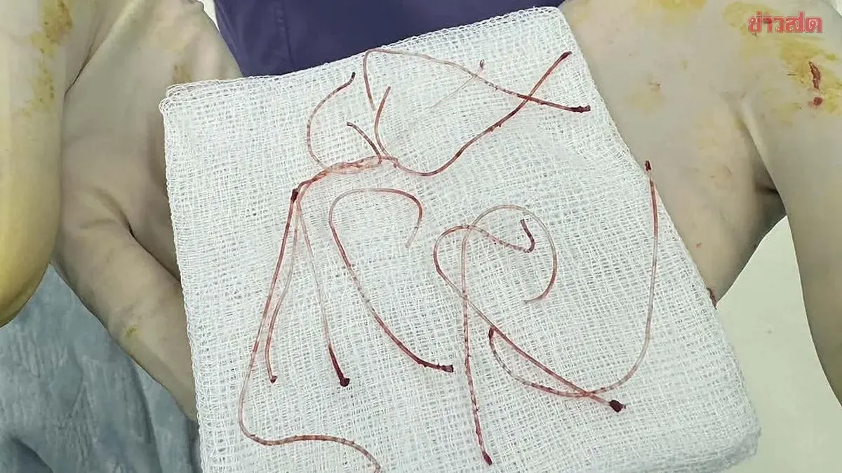 Multiple Patients Accuse Beauty Clinic of Botched Nose Surgery