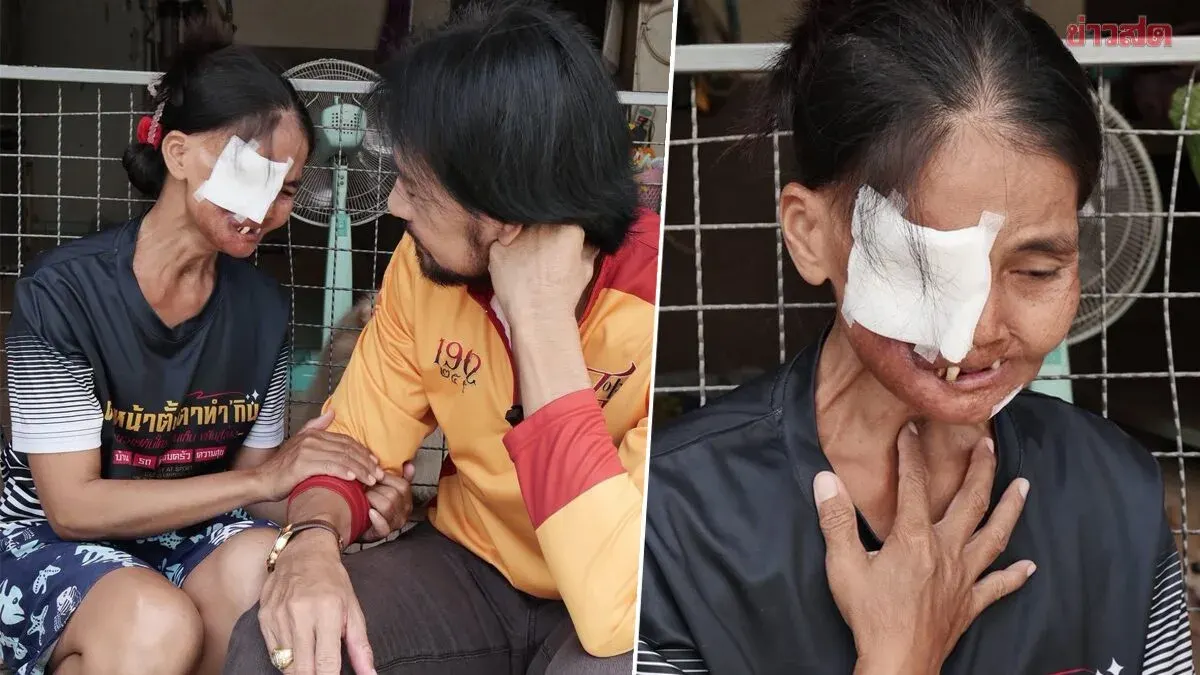 Celebrity Helps Cancer Patient Who Lost Eyes, Supports Blind Husband