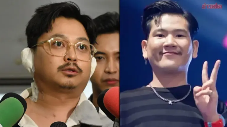 Band Leader Reports Burn Victim Din Stable After 80% Burns