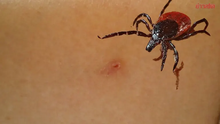 Thailand Monitors Tick-Borne Viral Fever Cases