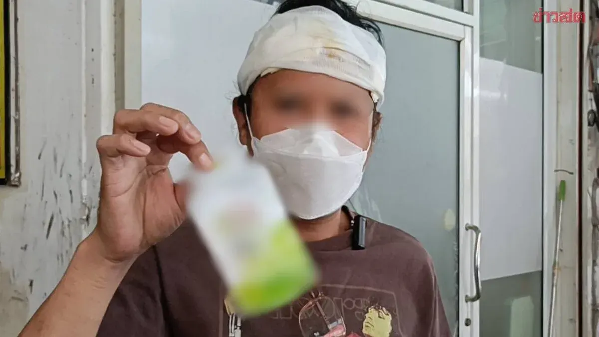 Man Suffers Severe Allergic Reaction After Buying Hair Dye Online, Wakes Up to Festering Scalp and Facial Swelling