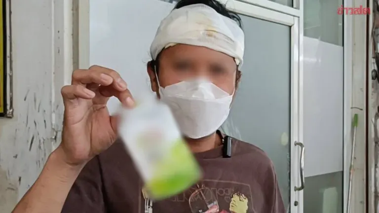 Man Suffers Severe Allergic Reaction After Buying Hair Dye Online, Wakes Up to Festering Scalp and Facial Swelling