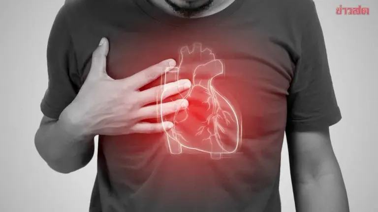 Doctor Explains Why Triple Vessel Disease Often Has No Warning Signs