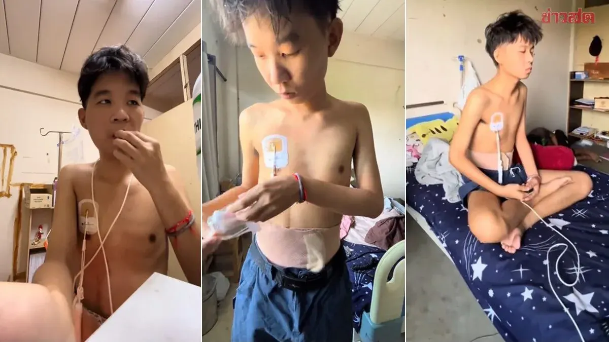 Young Man with Gardner Syndrome Develops Multiple Intestinal Tumors, Bowel Perforation; Treatment No Longer Possible
