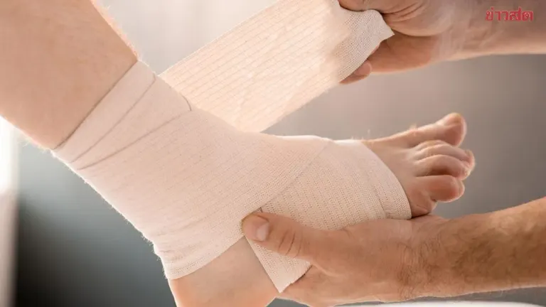 Twisted Ankle Nearly Proves Fatal From Blood Clot