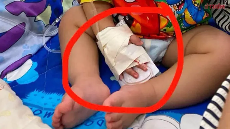 Hospital Offers 4,000 Baht After Nurse Severs Boy's Finger