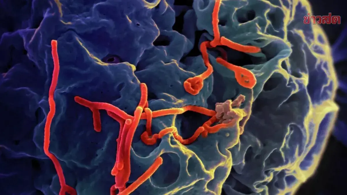 Renowned Doctor Discusses Ebola: Will It Spread to Thailand? Points to Disease Severity as a Natural Barrier to Transmission