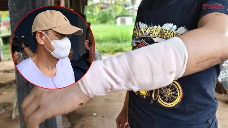 Father and Son Clash Over Religious Dispute, Fight Leaves Son With 13 Stitches