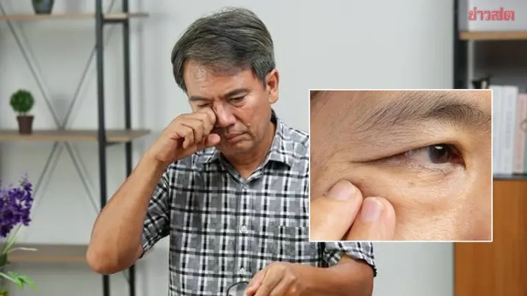 Chinese Man Nearly Blind After Slapping Eye Over Superstition