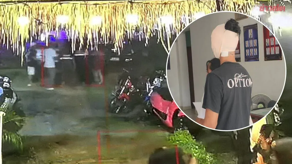 Customer Attacks Pub Owner with Broken Glass, Needs 47 Stitches
