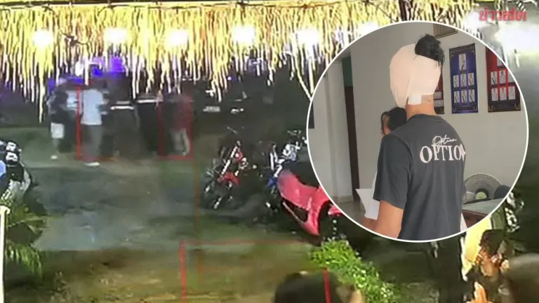 Customer Attacks Pub Owner with Broken Glass, Needs 47 Stitches
