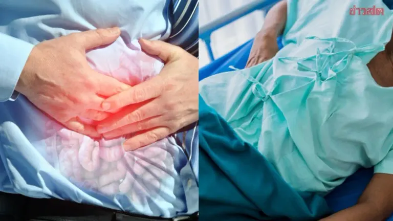 Executive Diagnosed With Rectal Cancer After Year-Long Weight Loss