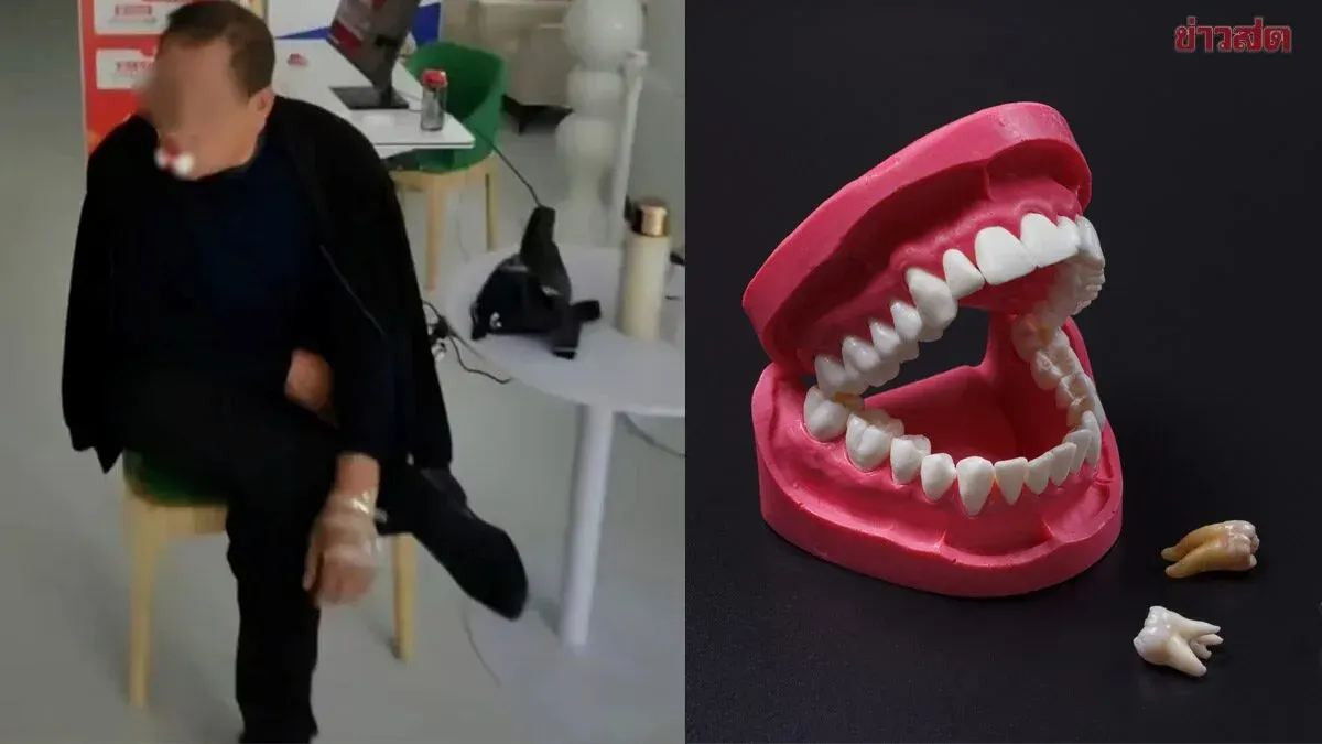 Chinese Man Shocked After 12 Teeth Extracted for Single Toothache