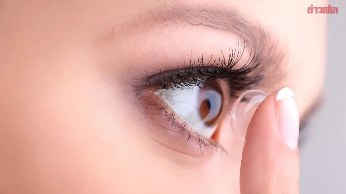 Woman Wore Colored Contact Lenses Daily for 20 Years Thinking It Was Just Dry Eyes—Doctor Warns Her Corneas Were Oxygen-Deprived Without Her Knowledge