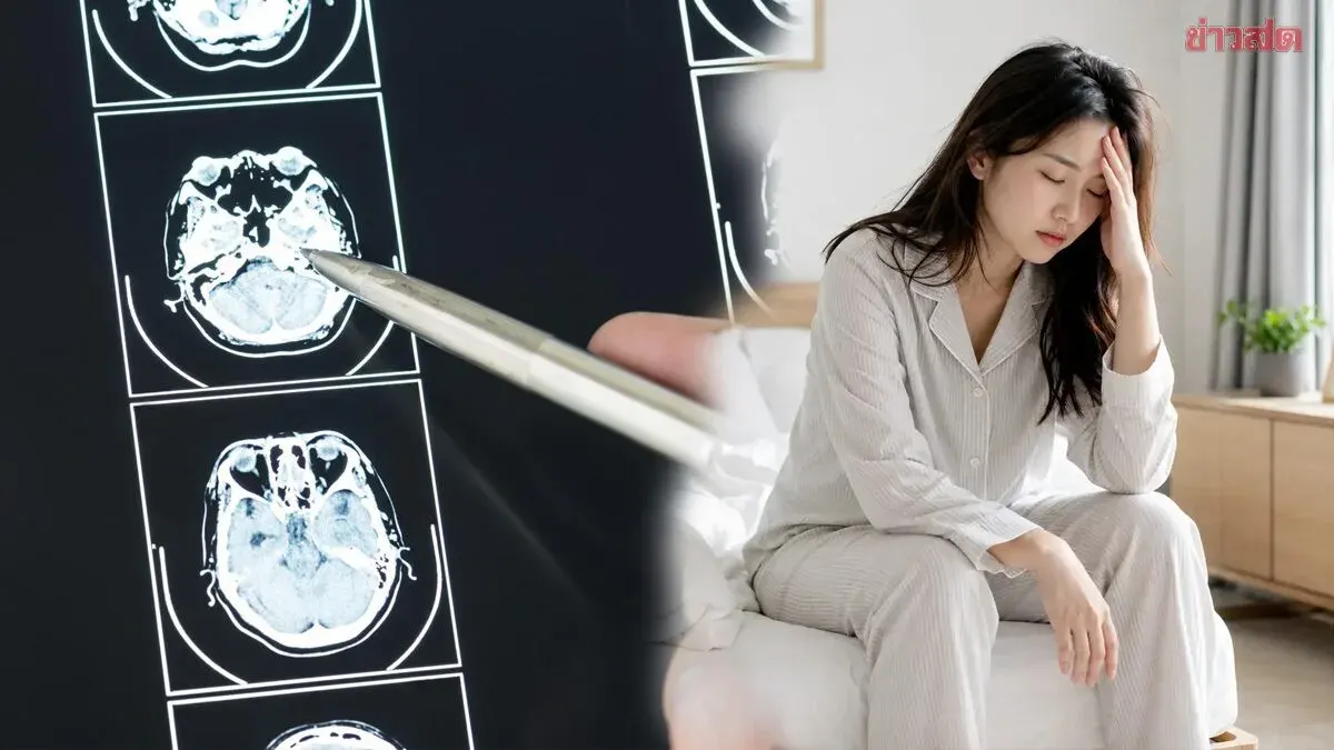 Frequent Filler Words May Signal Early Dementia Risk