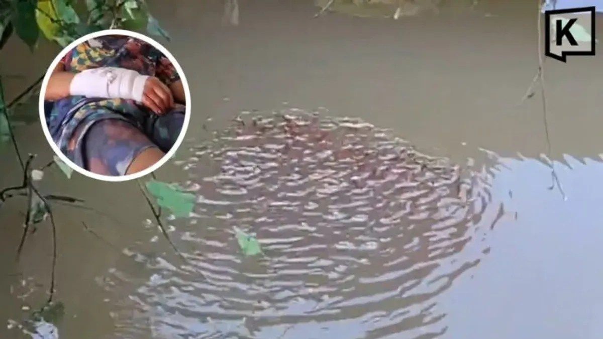 Boy Bitten by Giant Snakehead While Playing With Fry
