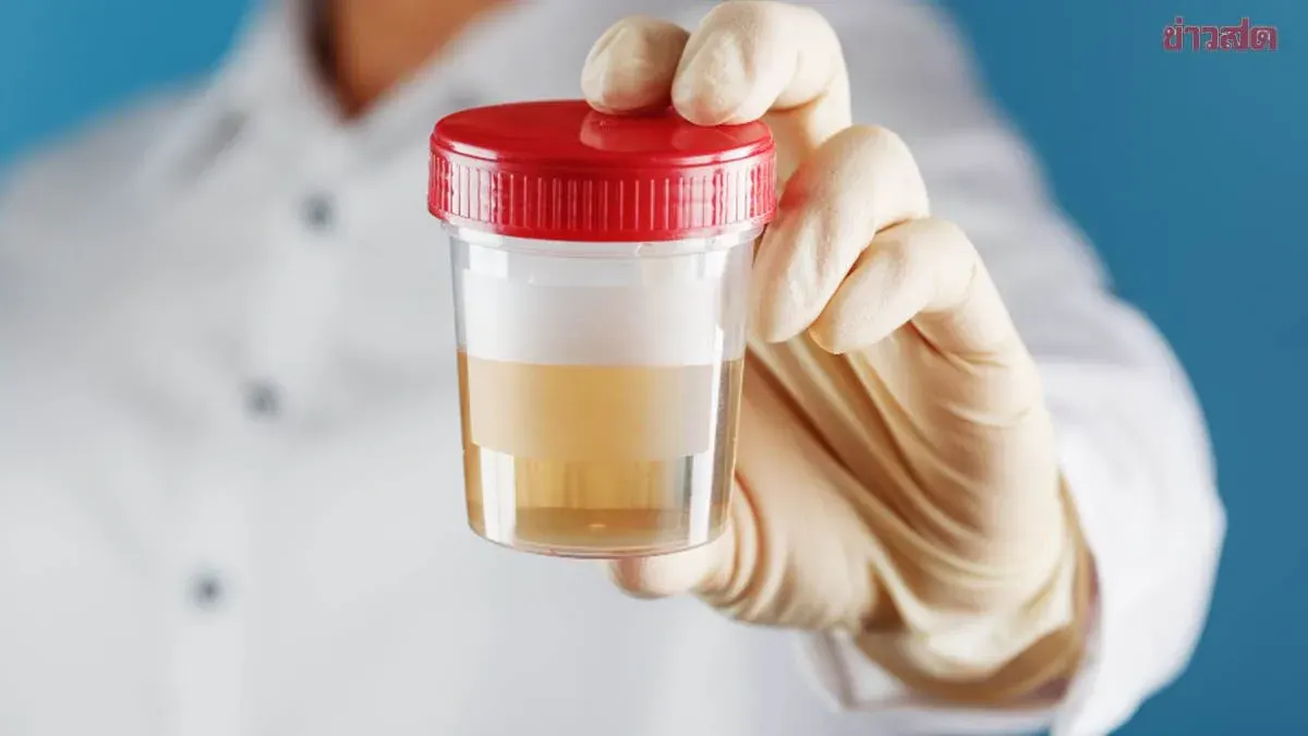 Blood in Urine? Doctors Reveal 5 Common Causes