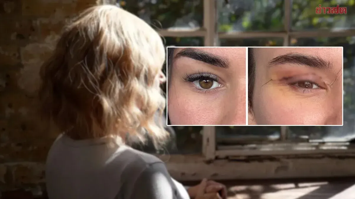 Cheap Eyelid Surgery Leaves Woman Nearly Blind After Botched Procedure
