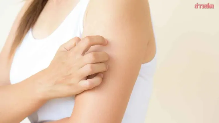 Check These Signs! If Your Skin Looks Like This, Be Careful—Your Liver May Be Malfunctioning