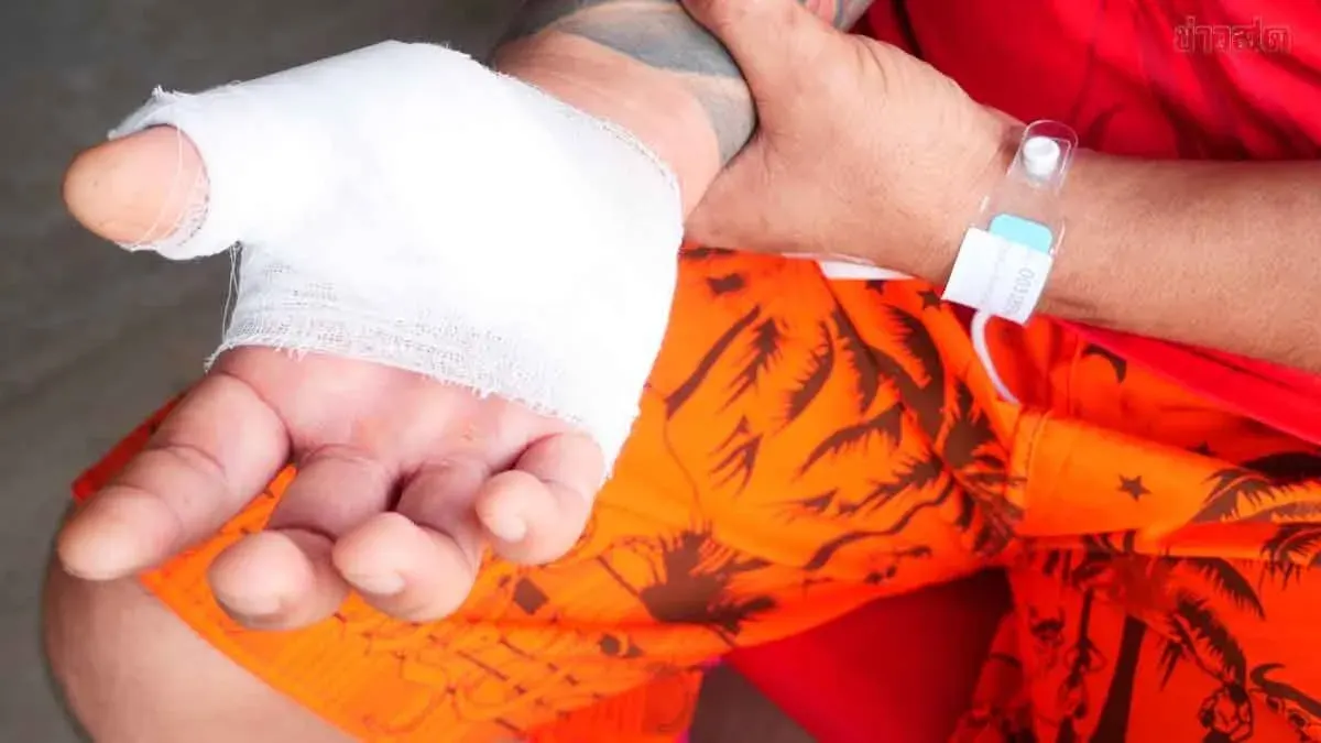 Man Mistook Wagging Dog for Friend, Severely Mauled