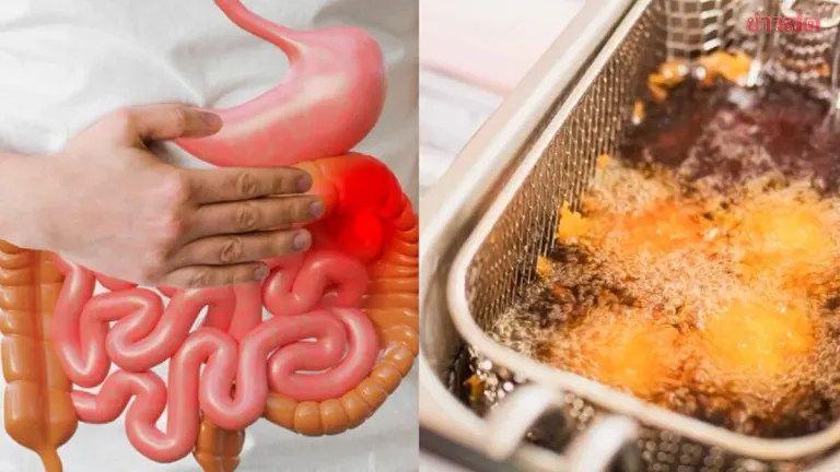 30-Year-Old's Daily Fried Rice Diet Leads to Colon Cancer