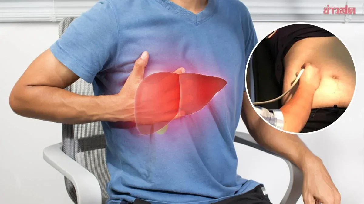 65-Year-Old's Liver Packed With Tumors After Month of Diarrhea