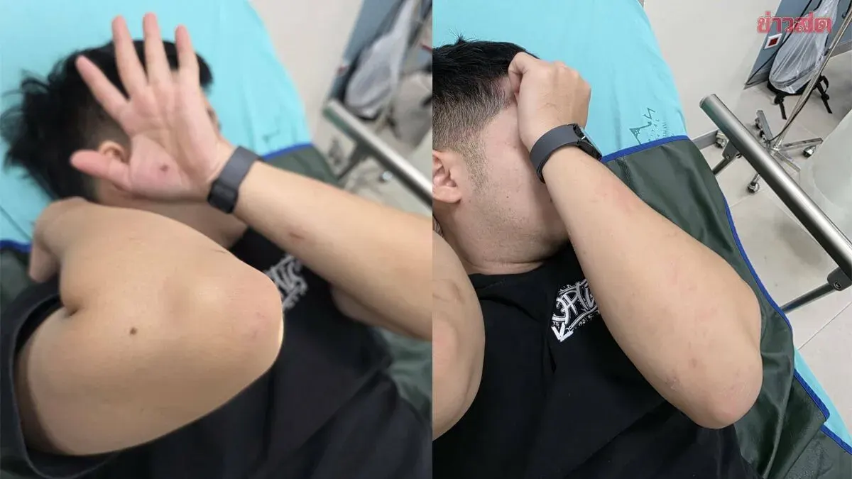 Man Attacked by Venue Guards in Nan After Bump