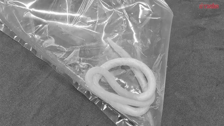 Why Roundworms Came Out of 2-Year-Old's Mouth