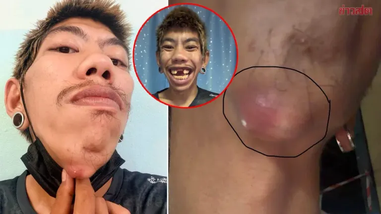 Influencer Frustrated by Hospital's Response to Emergency Pain
