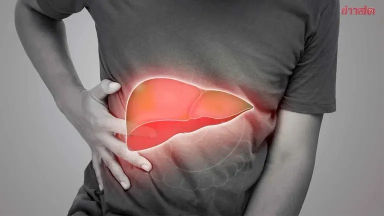 Doctor Warns of 10 Fatty Liver Disease Warning Signs