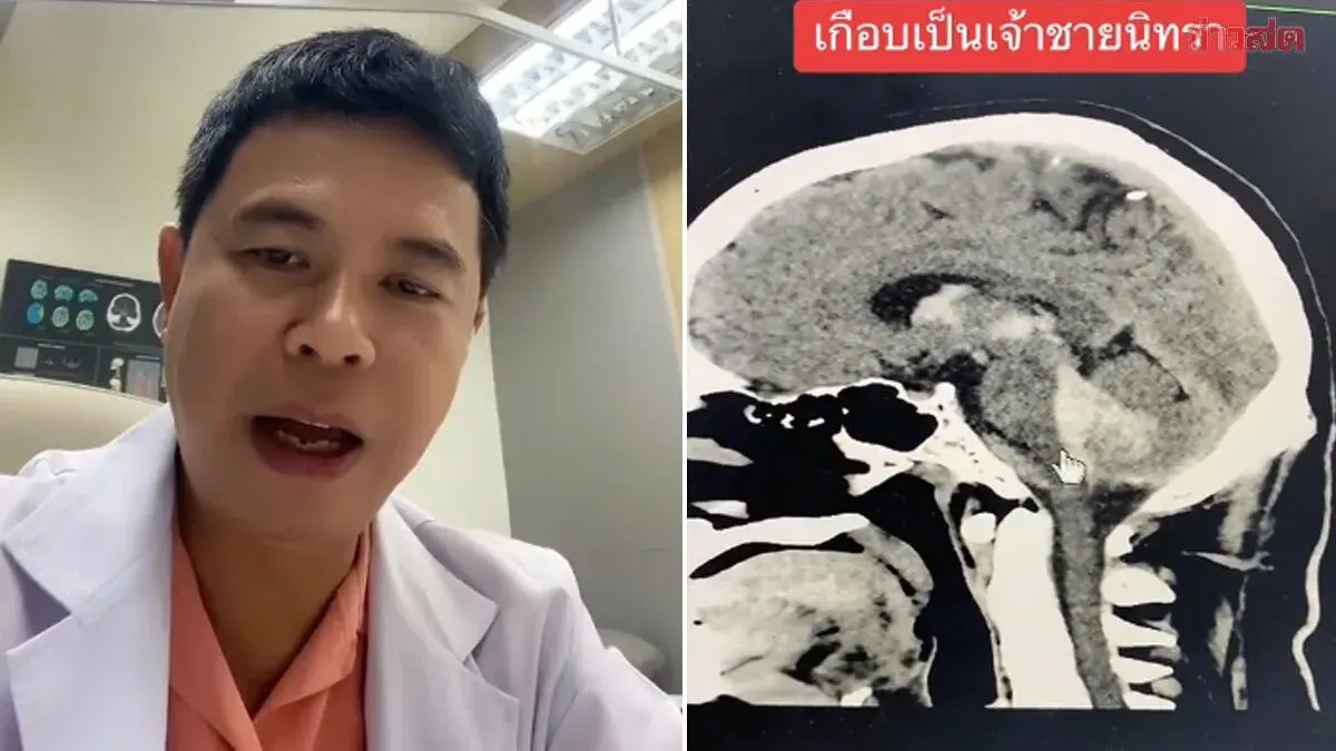 32-Year-Old Narrowly Escapes Brain Stem Death from Stroke