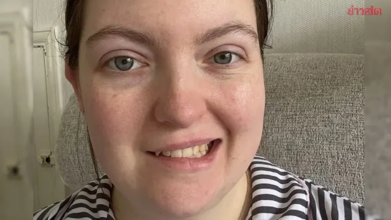British Woman's Ear Itch Escalates to Half-Face Paralysis