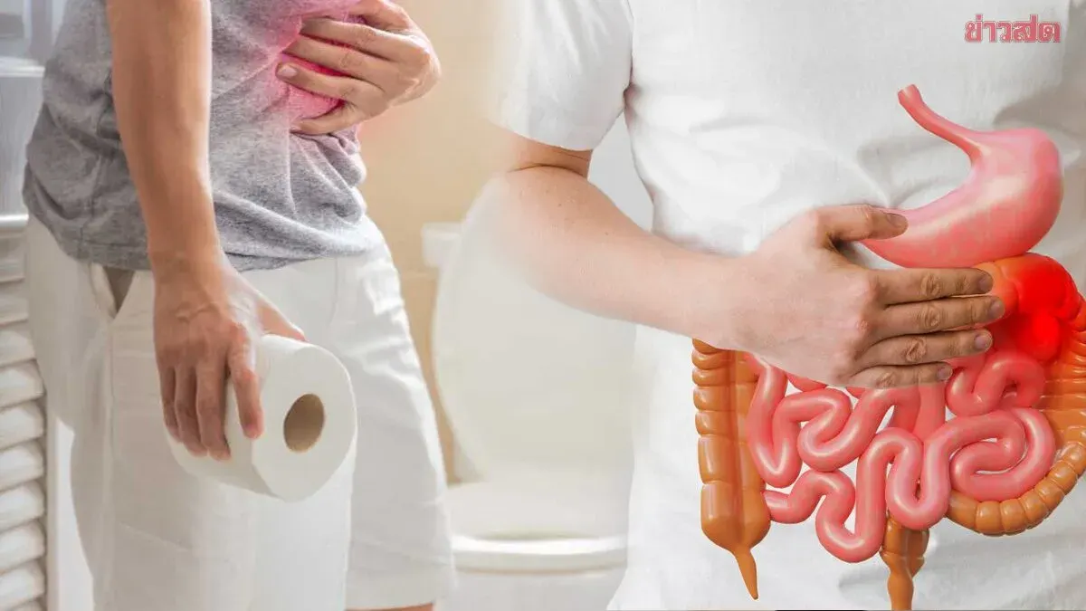 Doctors Warn: Bowel Incontinence May Signal Colorectal Cancer