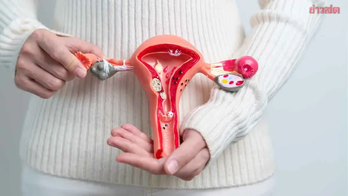 Warning Signs of Ovarian Cancer That Many Women Overlook Until It Spreads