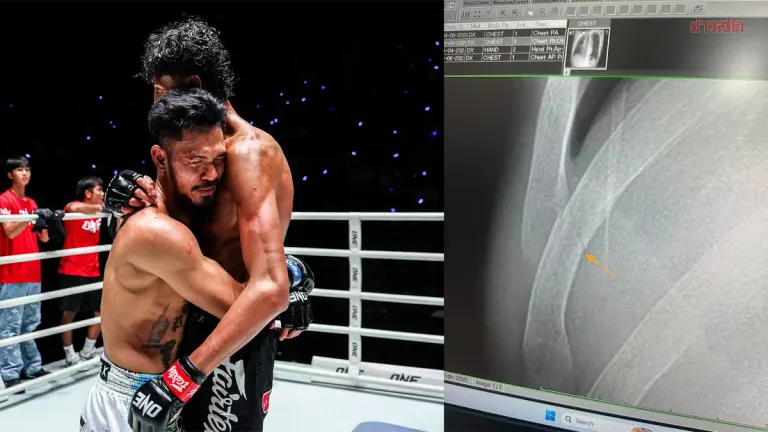 Muay Thai Fighter Sueakkim Sidelined Three Months With Broken Ribs