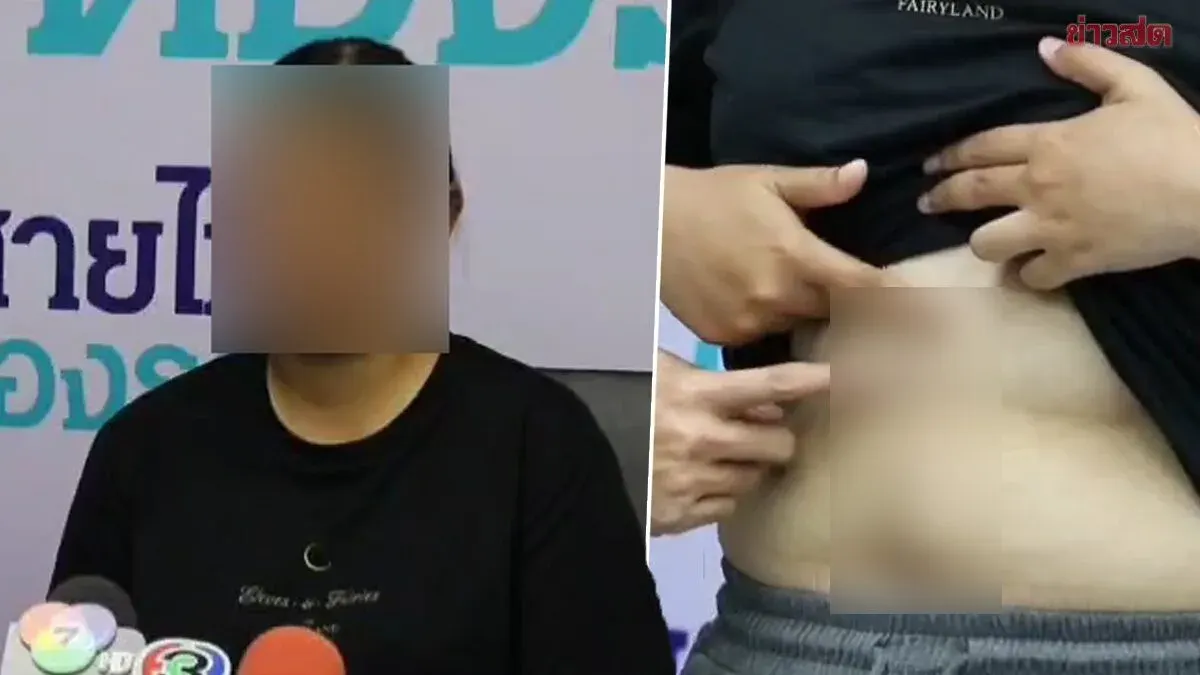 Woman Sues Hospital After Surgeon Accidentally Cuts Bile Duct